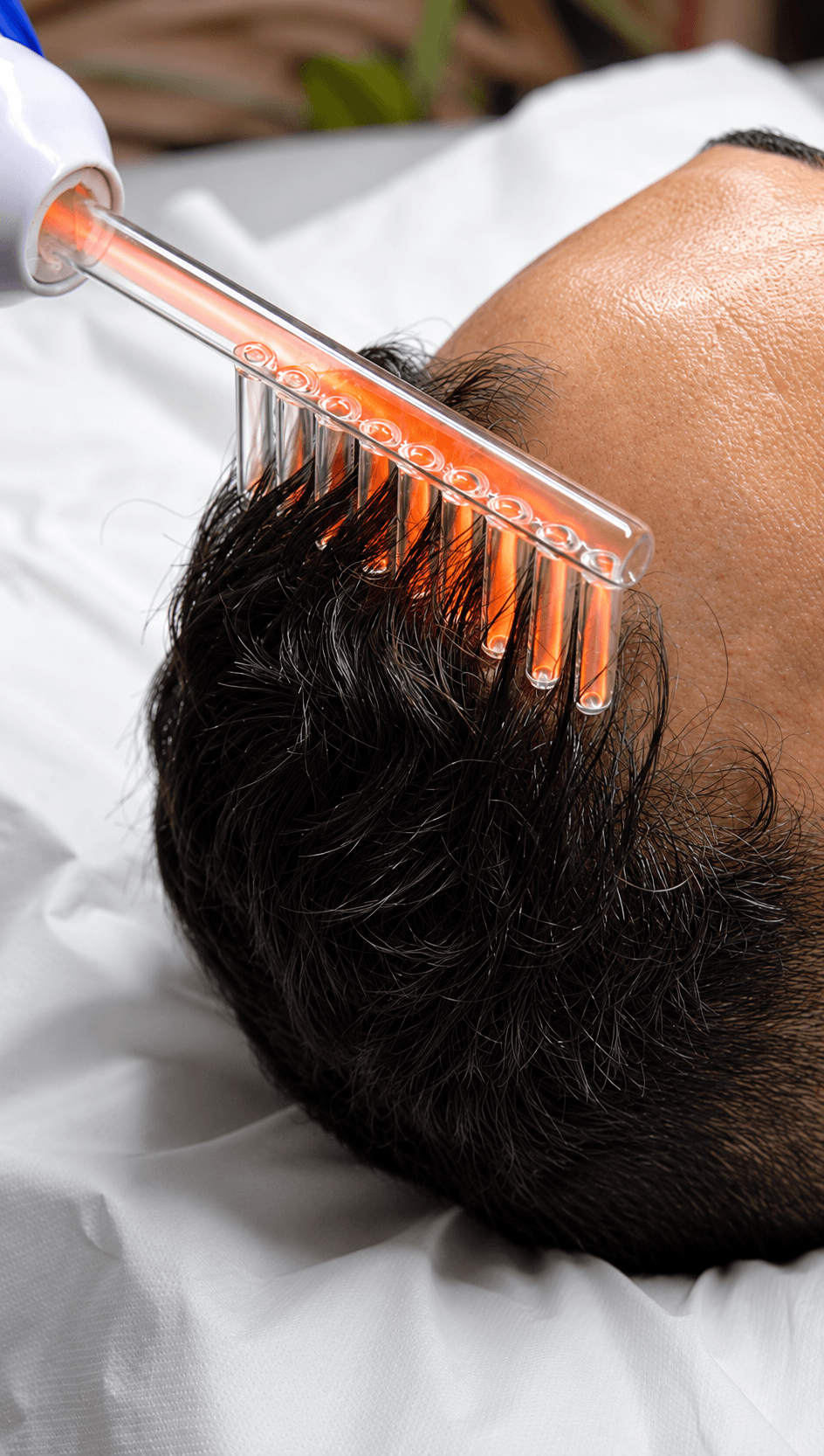 Hair Growth Treatment